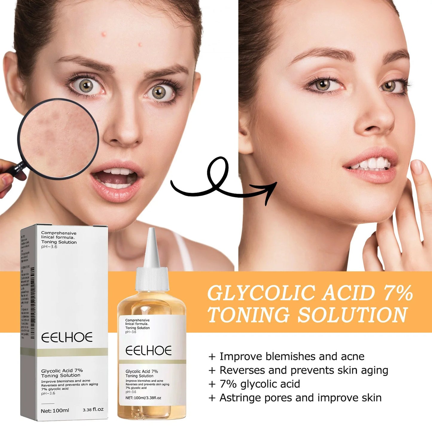 Eelhoe Glycolic Acid 7% Toning Solution with before and after effects on skin.